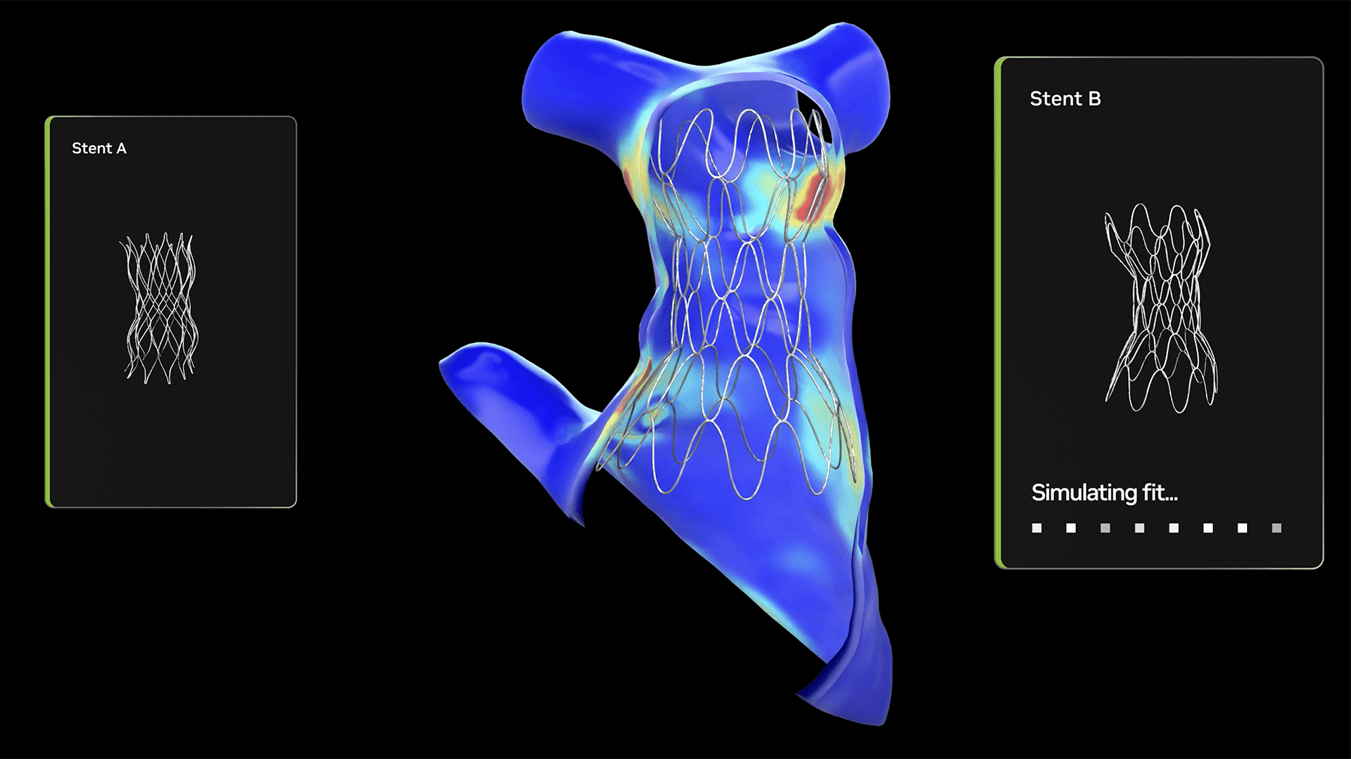 นวัตกรรมเพื่อเด็ก: รพ.เด็กในฟิลาเดลเฟียใช้ Open Source NVIDIA AI สร้างแบบจำลองหัวใจ 3 มิติในไม่กี่วินาที