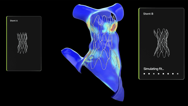 นวัตกรรมเพื่อเด็ก: รพ.เด็กในฟิลาเดลเฟียใช้ Open Source NVIDIA AI สร้างแบบจำลองหัวใจ 3 มิติในไม่กี่วินาที