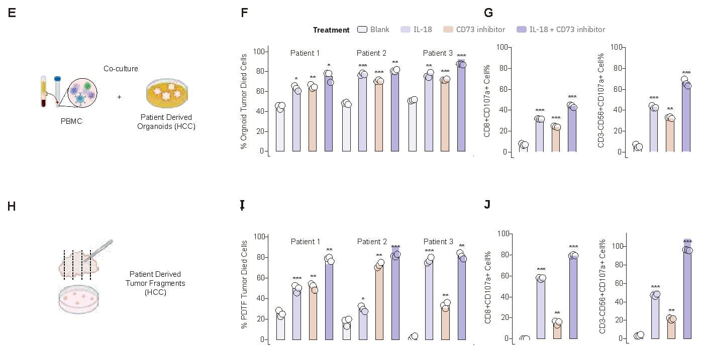 Bar charts showing results from patient-derived organoids and tumor fragments from three liver cancer patients. The charts compare the share of killed tumor cells and activated immune cells across four conditions: control, IL-18, CD73 inhibitor, and the combination of both.