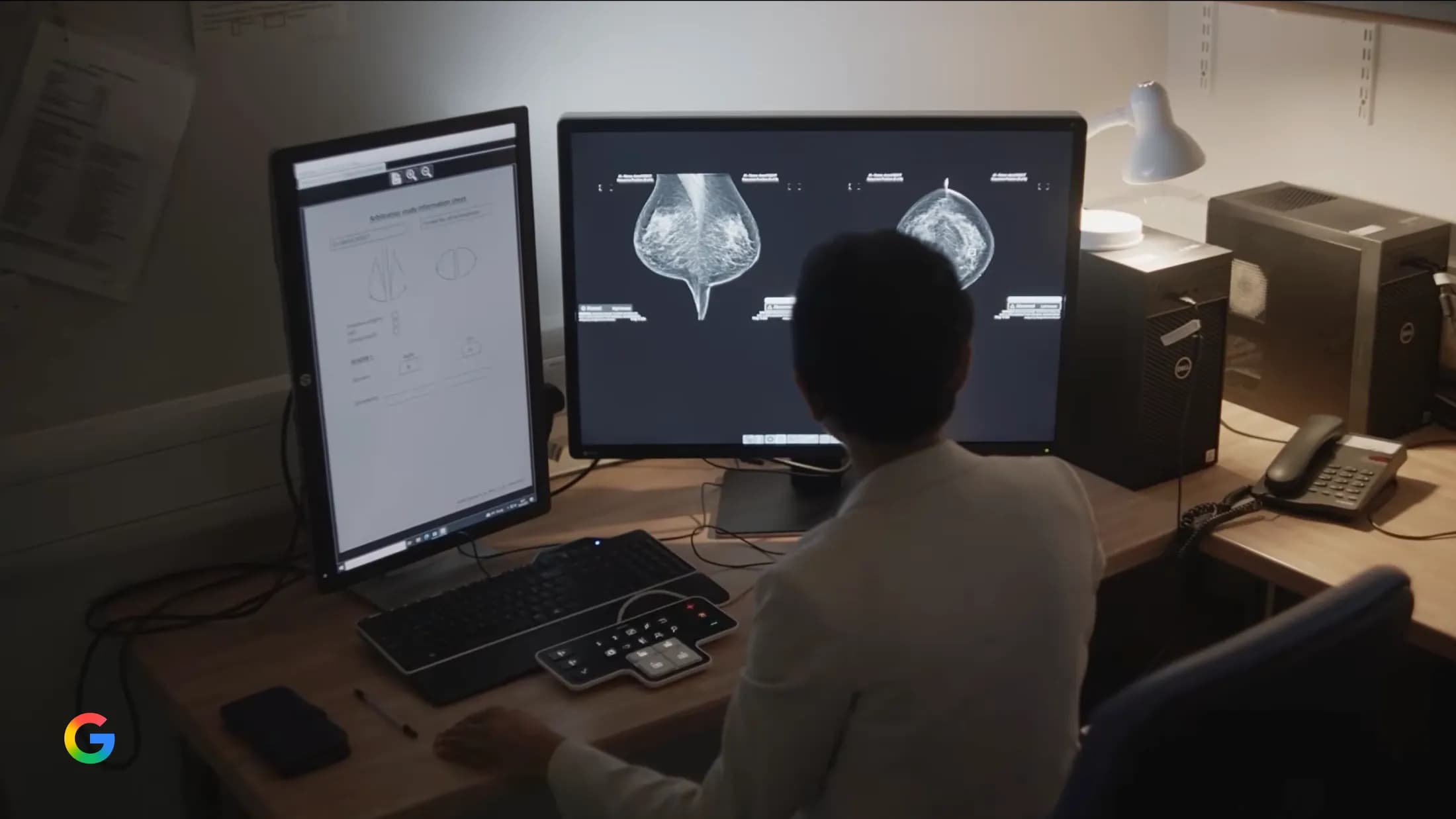 A healthcare professional sits at a desk reviewing mammogram scans and medical diagrams on dual computer monitors.